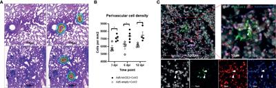 SARS-CoV-2 Infects Endothelial Cells In Vivo and In Vitro